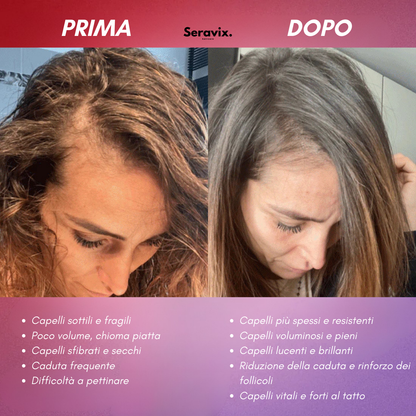 Seravix™ - Capelli più folti, forti e luminosi
